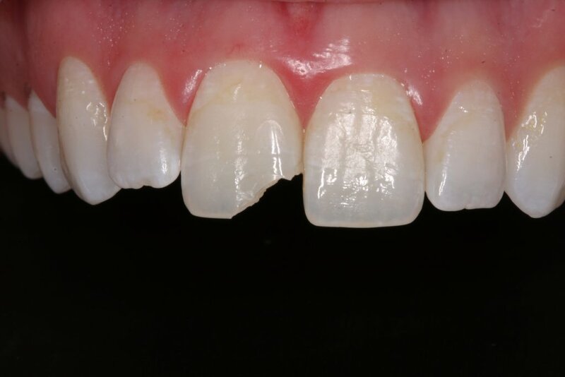 Dr. Andreea Barbulescu - cabinet stomatologic